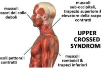 2 muscoli del collo cruciverba