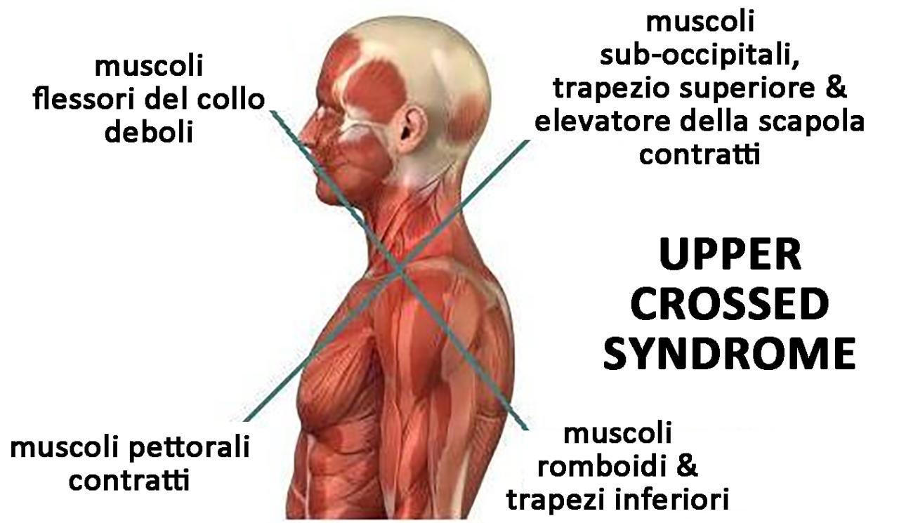 2 muscoli del collo cruciverba